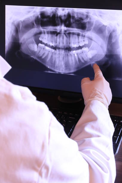 Best Emergency Root Canal Treatment in Bullard, TX